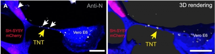 COVID: SARS-CoV-2 проникает в мозг через нанотрубки