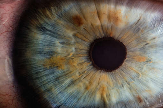 Российские медики разработали новый способ лечения роговицы глаза