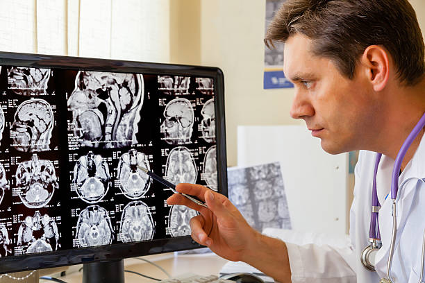врач рассматривает томограмм мозга