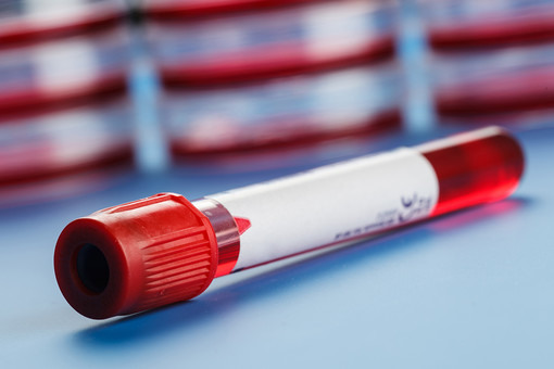 Ученые придумали, как предсказать риск развития лейкемии по анализу крови